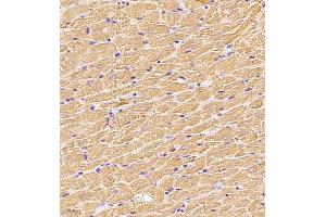 Immunohistochemistry (Paraffin-embedded Sections) (IHC (p)) image for anti-Myosin Light Chain 6, Alkali, Smooth Muscle and Non Muscle (MYL6) antibody (ABIN7074734)