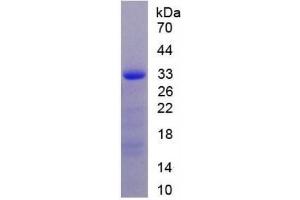SDS-PAGE, Sample: Active recombinant TXLNa, Human