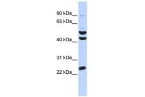 ZNF200 Antikörper  (AA 324-373)