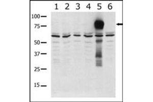 Western blot analysis of anti-K5 b (ABIN392438 and ABIN2842036) in lysates from transiently transfected COS7 cells. (PAK7 Antikörper  (AA 168-198))