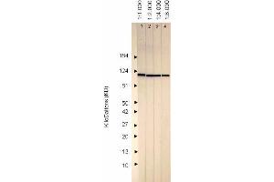 Western Blotting (WB) image for anti-Herpes Simplex Virus Type 1 ICP0 (HSV1 ICP0) antibody (ABIN265560)