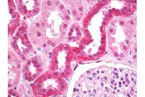 Anti-FIH / CASR antibody IHC of human kidney, tubules. (CASR Antikörper  (AA 214-235))