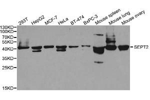 Western blot analysis of extracts of various cell lines, using SEPT2 antibody. (Septin 2 Antikörper  (AA 112-361))