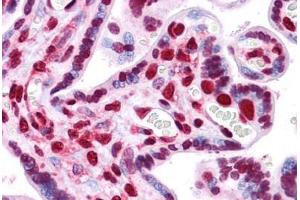Human Placenta: Formalin-Fixed, Paraffin-Embedded (FFPE) (HMGB1 Antikörper  (AA 1-91))