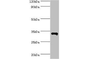 Western blot All lanes: RNF212 antibody at 14 μg/mL + HepG2 whole cell lysate Secondary Goat polyclonal to rabbit IgG at 1/10000 dilution Predicted band size: 34, 15, 22, 32, 27, 31 kDa Observed band size: 34 kDa