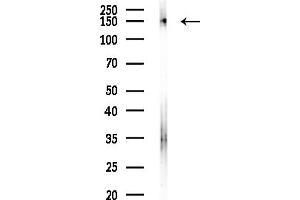 anti-Kinesin Family Member 17 (KIF17) (C-Term) antibody
