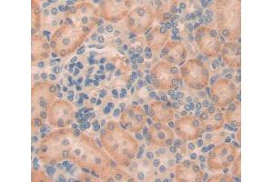Used in DAB staining on fromalin fixed paraffin- embedded kidney tissue (Phospholipase C beta 2 Antikörper  (AA 1-250))