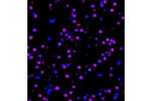Immunofluorescent analysis of paraffin embedded mouse brain using MED8 (ABIN7074582) at dilution of 1: 600 (MED8 Antikörper)
