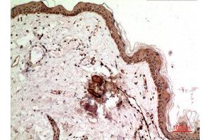 Immunohistochemistry (IHC) analysis of paraffin-embedded Human Skin, antibody was diluted at 1:100. (Synovial Sarcoma, X Breakpoint 2B (SSX2B) (C-Term) Antikörper)