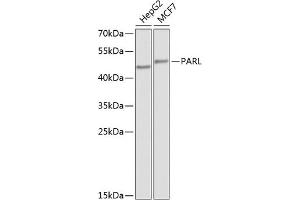 Western blot analysis of extracts of various cell lines, using PARL antibody (ABIN6132564, ABIN6145228, ABIN6145229 and ABIN6224252) at 1:1000 dilution. (PARL Antikörper  (AA 1-170))