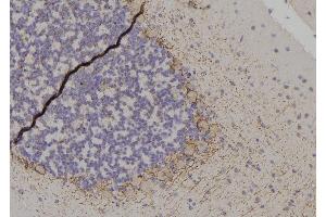 ABIN6256515 and ABIN6267566 at 1/100 staining Rat brain tissue by IHC-P. (14-3-3 zeta Antikörper  (pThr232))