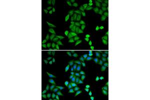 Immunofluorescence analysis of MCF-7 cells using RBPJ antibody. (RBPJ Antikörper)