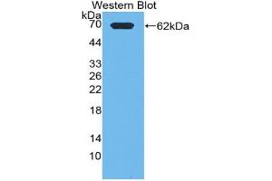 Western blot analysis of the recombinant protein. (PIK3C2A Antikörper  (AA 349-611))