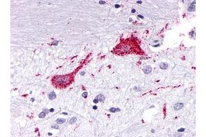 Immunohistochemical staining of Brain (Neurons and glia) using anti- KISS1R antibody ABIN122164 (KISS1R Antikörper  (Cytoplasmic Domain))