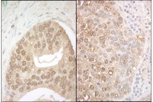 anti-Anaphase Promoting Complex Subunit 7 (ANAPC7) (AA 515-565) antibody
