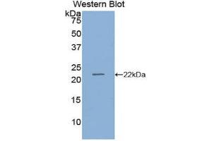 Western Blotting (WB) image for anti-Retinol Binding Protein 4, Plasma (RBP4) (AA 19-201) antibody (ABIN1078485)