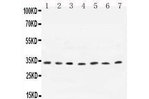 Anti- Cyclin D1 antibody,  All Western blotting All lanes: Anti-CCND1() at 0.