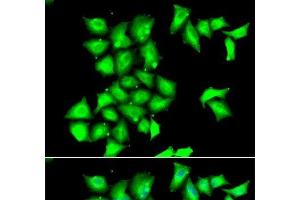 Immunofluorescence analysis of HeLa cells using MSRB1 Polyclonal Antibody