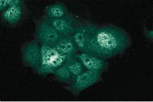 Immunofluorescent staining of MCF7 cells with anti-XIAP/hILP antibody. (XIAP Antikörper  (AA 268-426))