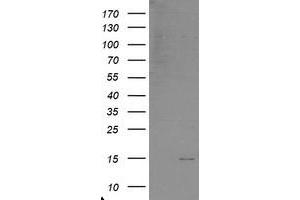 Western Blotting (WB) image for anti-Chromosome 17 Open Reading Frame 37 (C17orf37) antibody (ABIN1501777) (C17orf37 Antikörper)