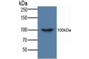 Figure. (FADD Antikörper  (AA 7-178))
