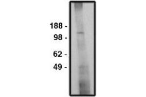 Image no. 1 for anti-Solute Carrier Family 9 (Sodium/hydrogen Exchanger), Member 6 (SLC9A6) antibody (ABIN265251) (SLC9A6 Antikörper)