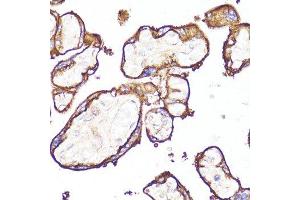Immunohistochemistry (Paraffin-embedded Sections) (IHC (p)) image for anti-Membrane Metallo-Endopeptidase (MME) (AA 52-352) antibody (ABIN6143900)