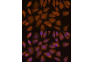 Immunofluorescence analysis of L929 cells using GCLC Rabbit pAb (ABIN6130444, ABIN6141016, ABIN6141017 and ABIN6214615) at dilution of 1:100 (40x lens).