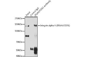 Immunoprecipitation analysis of 200 μg extracts of C6 cells using 3 μg Integrin alpha V (ITGAV/CD51) antibody (ABIN3022887, ABIN3022888, ABIN3022889 and ABIN6219281).