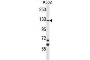 Western Blotting (WB) image for anti-MCF.2 Cell Line Derived Transforming Sequence (MCF2) antibody (ABIN2996823) (MCF2 Antikörper)