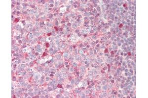 Immunohistochemistry (Paraffin-embedded Sections) (IHC (p)) image for anti-serpin Peptidase Inhibitor, Clade B (Ovalbumin), Member 9 (SERPINB9) (AA 122-150) antibody (ABIN1805677)