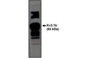 Image no. 1 for anti-Potassium Voltage-Gated Channel, Shaw-Related Subfamily, Member 1 (KCNC1) antibody (ABIN265028)
