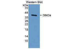 Detection of Recombinant ARPC2, Human using Polyclonal Antibody to Actin Related Protein 2/3 Complex Subunit 2 (ARPC2)