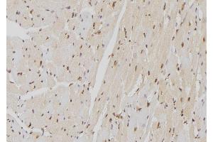 ABIN6262924 and ABIN6277599 at 1/100 staining Mouse heart tissue by IHC-P. (Lamin B Receptor Antikörper  (Internal Region))