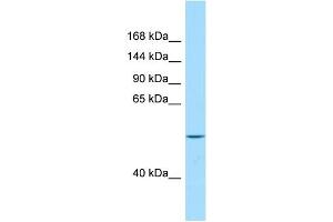 WB Suggested Anti-VPS13B Antibody Titration: 1.