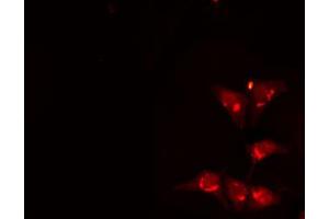 ABIN6274122 staining HuvEc cells by IF/ICC. (MAF Antikörper  (C-Term))
