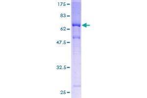 Image no. 1 for Melanoma Antigen Family A, 11 (MAGEA11) (AA 1-319) protein (GST tag) (ABIN1310031) (MAGEA11 Protein (AA 1-319) (GST tag))