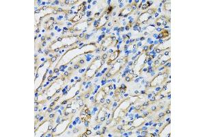 Immunohistochemistry of paraffin-embedded mouse kidney using COPB2 antibody. (COPB2 Antikörper)
