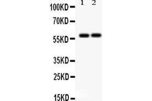 Anti-SCARB1 Picoband antibody, Western blotting All lanes: Anti SCARB1  at 0. (SCARB1 Antikörper  (C-Term))