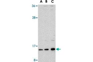 Western blot analysis of SUMO1 in HL-60 cell lysate with SUMO1 polyclonal antibody  at (A) 0. (SUMO1 Antikörper  (N-Term))