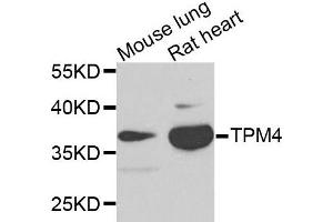 Western blot analysis of extracts of mouse lung and rat heart cells, using TPM4 antibody.