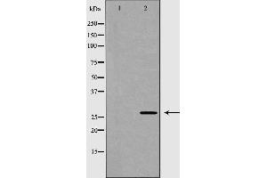 Western blot analysis of Hela whole cell lysates, using HSD17B10 Antibody. (HSD17B10 Antikörper  (Internal Region))