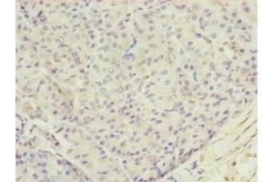 Immunohistochemistry of paraffin-embedded human pancreatic tissue using ABIN7173719 at dilution of 1:100 (TTLL7 Antikörper  (AA 1-260))