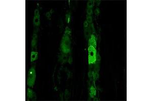 IF on rat trigeminal using Mouse monoclonal antibody to rat p75NTR (ABIN350707) at a concentration of 10 µg/ml. (NGFR Antikörper)