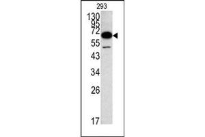Image no. 1 for anti-Methionyl Aminopeptidase 2 (METAP2) (N-Term) antibody (ABIN357679) (METAP2 Antikörper  (N-Term))