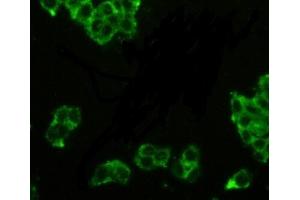 Detection of PAP in MCF7 cells using Polyclonal Antibody to Prostatic Acid Phosphatase (PAP) (ACPP Antikörper  (AA 217-386))