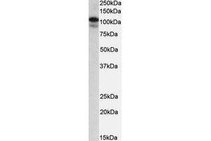 Western Blotting (WB) image for anti-SATB Homeobox 1 (SATB1) (AA 668-681) antibody (ABIN1493900) (SATB1 Antikörper  (AA 668-681))
