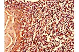 Immunohistochemistry of paraffin-embedded human tonsil tissue using ABIN7174965 at dilution of 1:100 (Myosin X Antikörper  (AA 1-97))