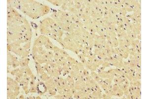 Immunohistochemistry of paraffin-embedded human heart tissue using ABIN7157020 at dilution of 1:100 (KCNJ4 Antikörper  (AA 316-445))