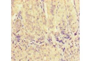 Immunohistochemistry of paraffin-embedded human adrenal gland tissue using ABIN7175563 at dilution of 1:100